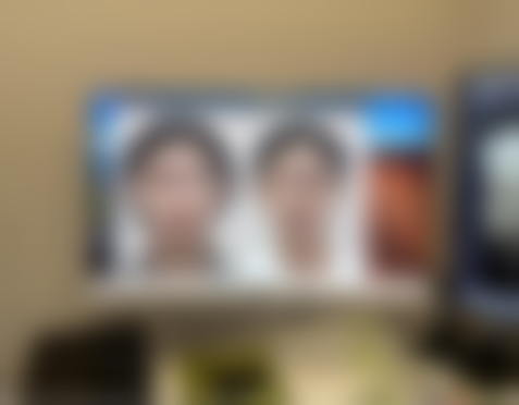 术后护理对去眼袋修复时间的影响