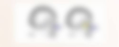 瘢痕体质可以埋线双眼皮吗？多数不建议，极少数经严格评估可尝试，还有这些风险要知悉！ 