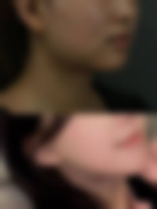 六、仁寿滤镜主义整形医院口碑如何？