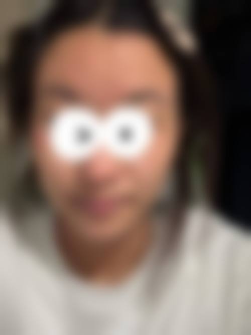 四、西安灵韵天鹅医疗美容诊所特色项目