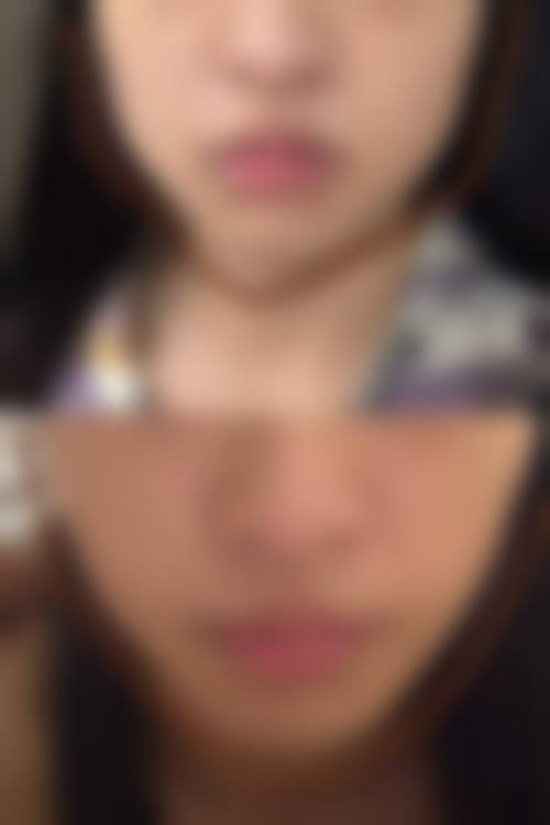 五、成都拉维佳整形医疗美容诊所收费价格表