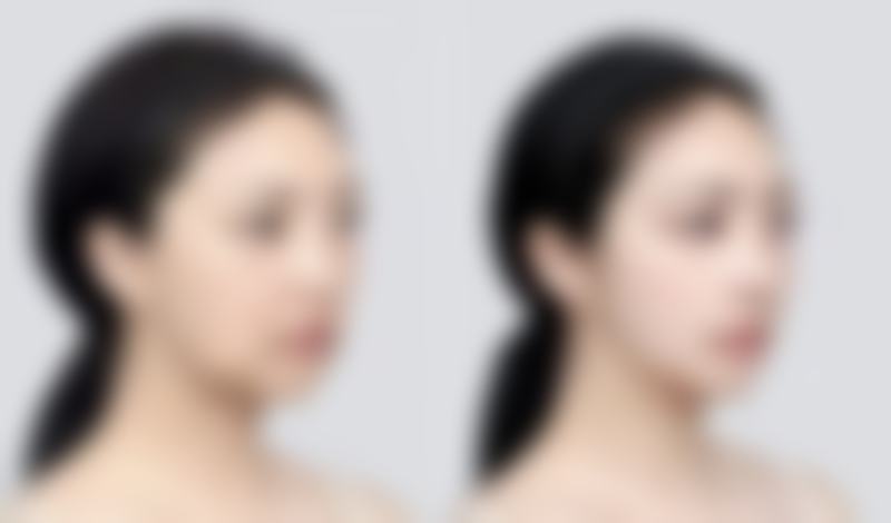 二、诸暨欧莱美整形张宝生医生擅长项目