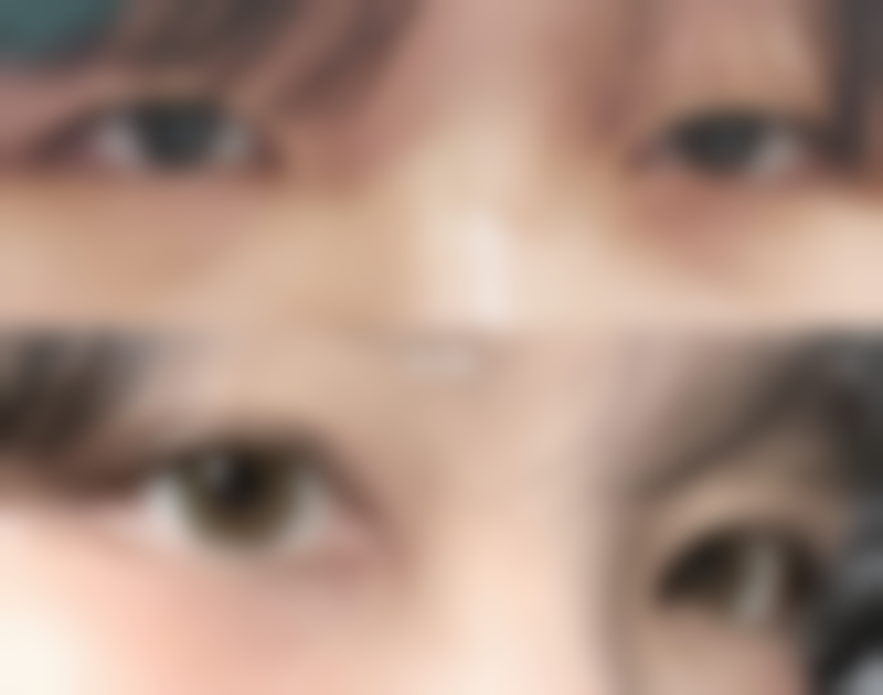 七、诸暨欧莱美整形张宝生医生怎么预约？