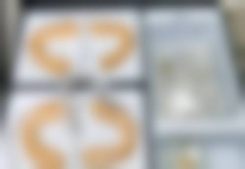 五、郑州至美医疗美容尹锡荣医生技术怎么样？