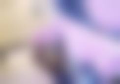 五、厦门思明安黛美整形刘富植医生技术怎么样?