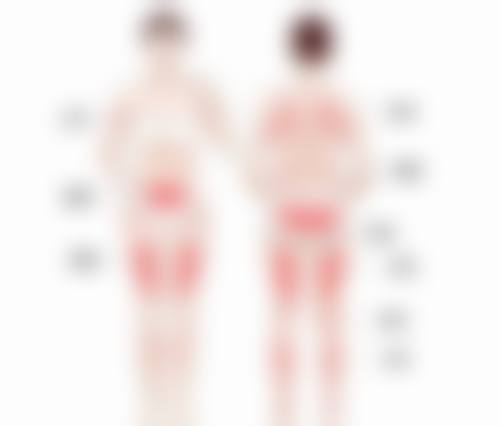 不同人群适配的假体隆胸尺寸