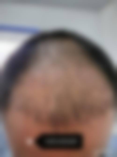 四、银川唯希医疗美容诊所特色项目