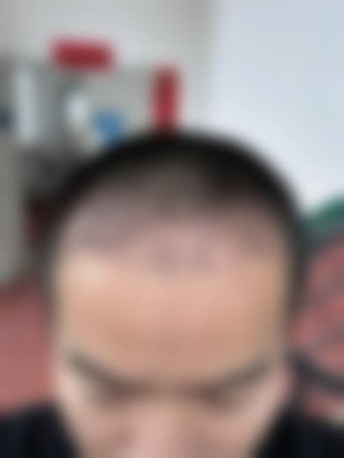 六、银川唯希医疗美容诊所口碑如何?