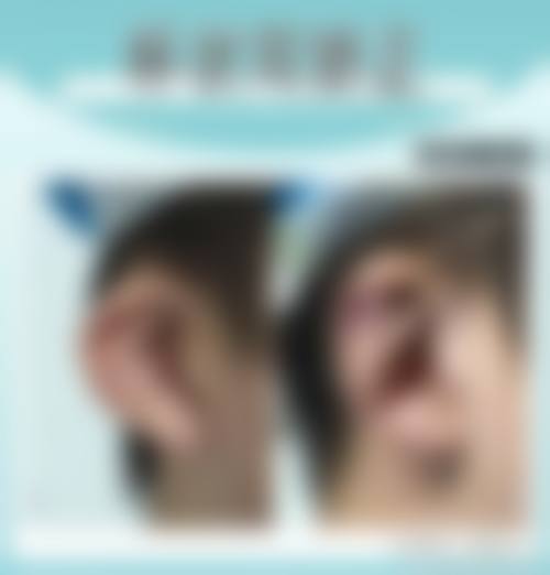 五、银川唯希医疗美容诊所收费价格表