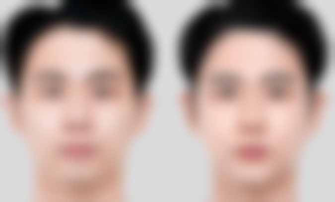 柳东熙医生技术怎么样?