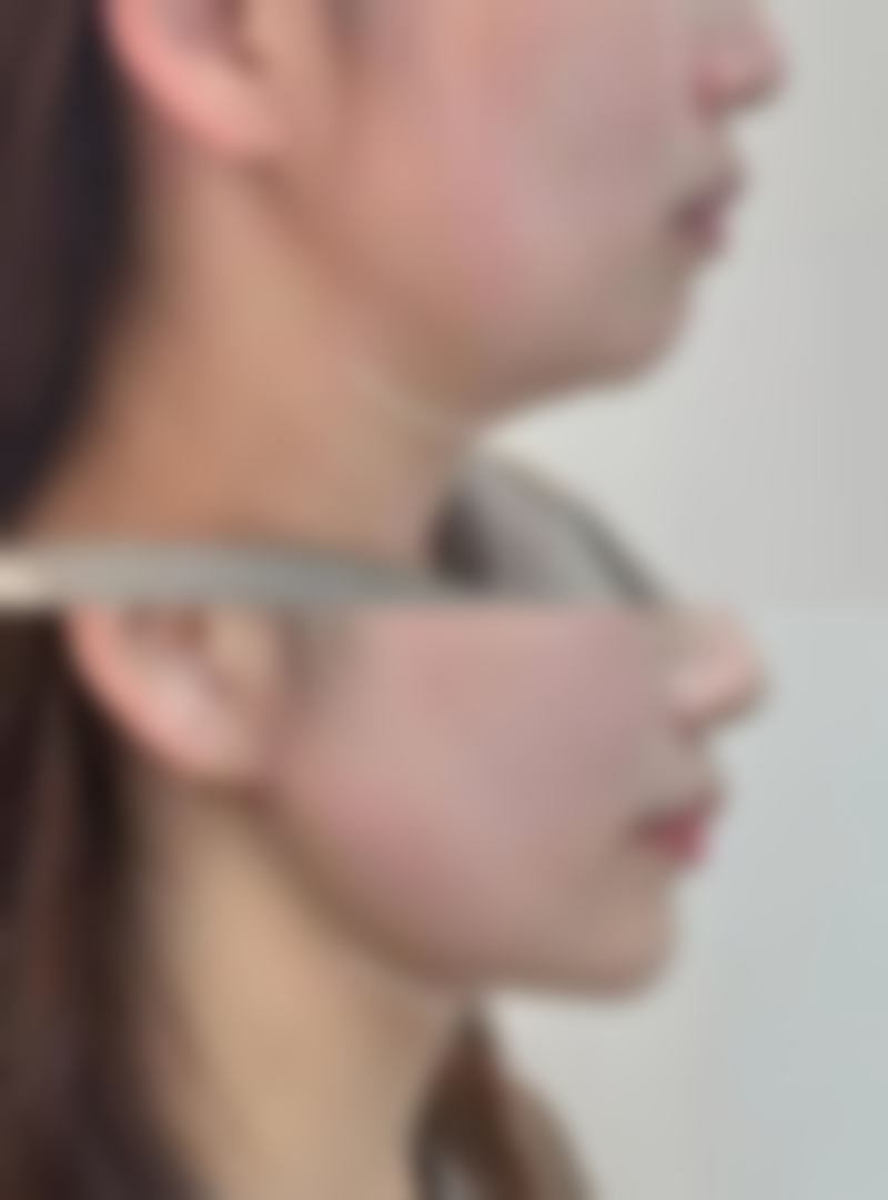 四、韩国DREAM梦想整形金姬庚医生坐诊医院