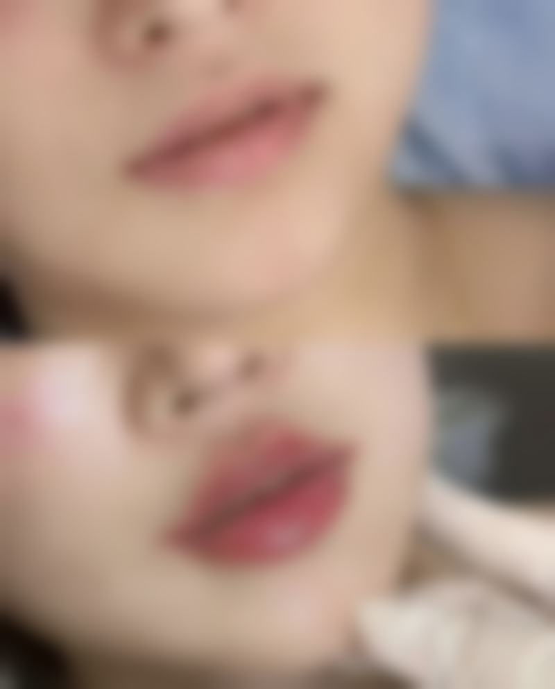 五、韩国DREAM梦想整形金姬庚医生技术怎么样？