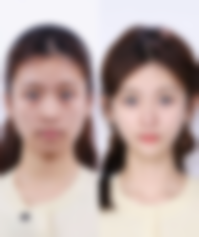 柳东熙医生擅长项目