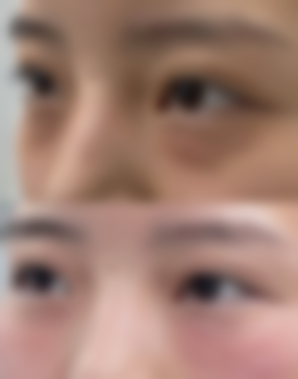 柳东熙医生怎么预约?