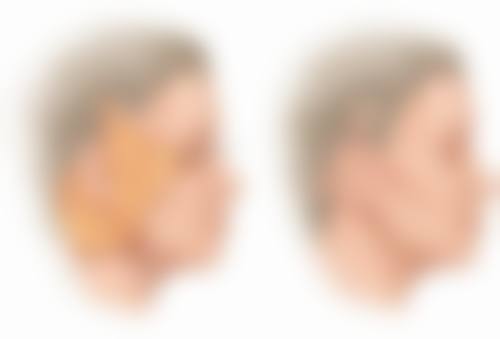 八、深圳宝安中 心医院皮肤美容科怎么预约？