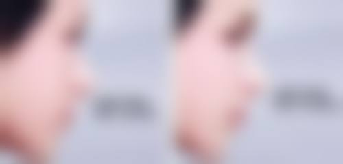 三、深圳宝安中 心医院皮肤美容科医生介绍