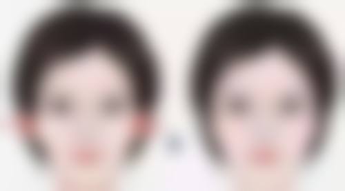 五、上海美道医疗美容黄晓娟医生技术怎么样？