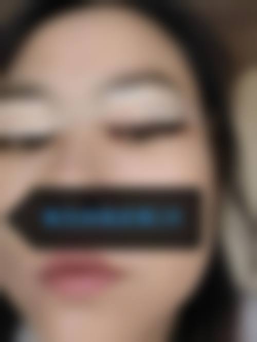 六、乌鲁木齐艺颜智美整形医院口碑如何?