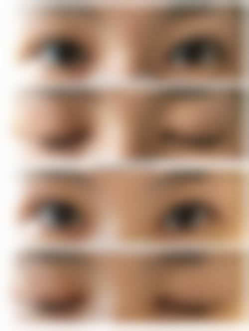 四、乌鲁木齐艺颜智美整形医院特色项目