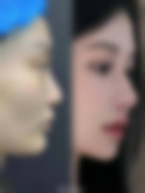 四、怀化卓莱兰积整形医院特色项目