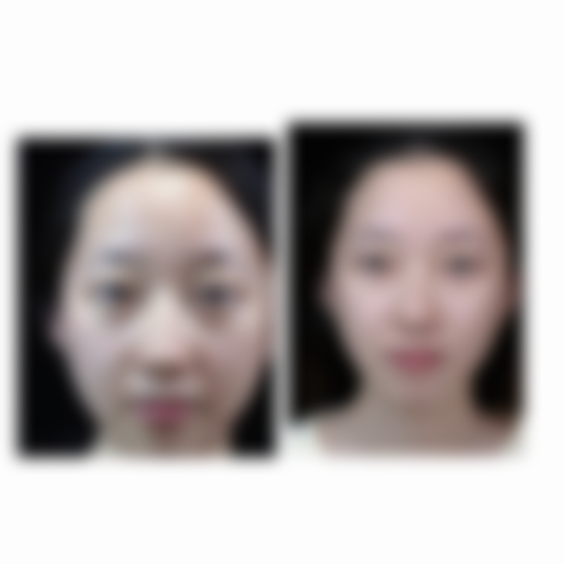 四、成都华美紫馨医美口腔医院特色项目