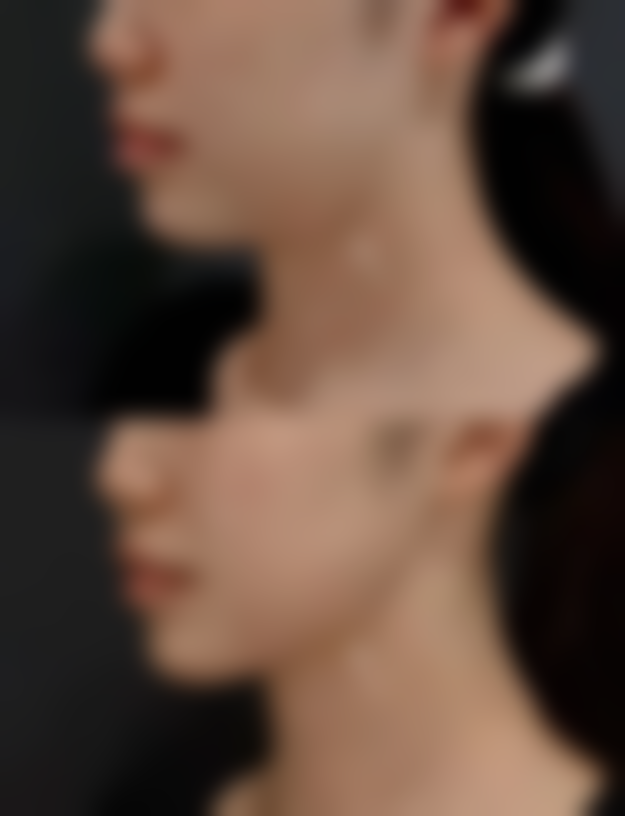 六、上海美道医疗美容黄晓娟医生口碑评价及真人实例反馈