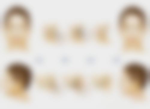 使用疤痕贴淡化疤痕色素的注意事项