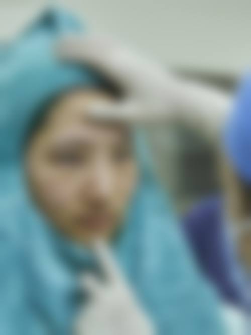 四、哈尔滨市唐雪菲医疗美容诊所特色项目