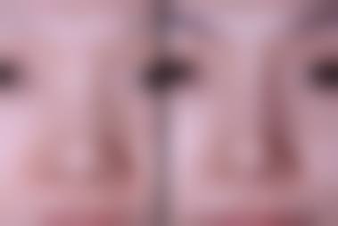 三、西安简美整形医院医生介绍