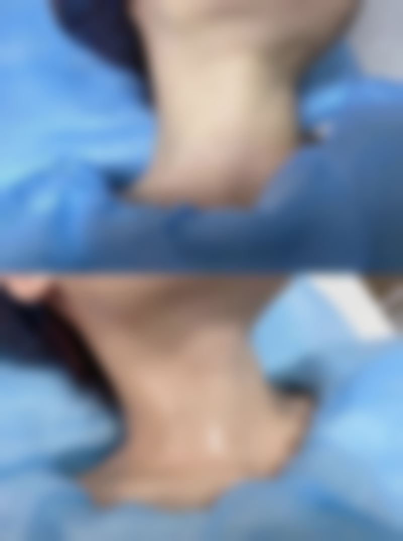 二、长沙禾丽医疗美容刘华荣医生擅长项目