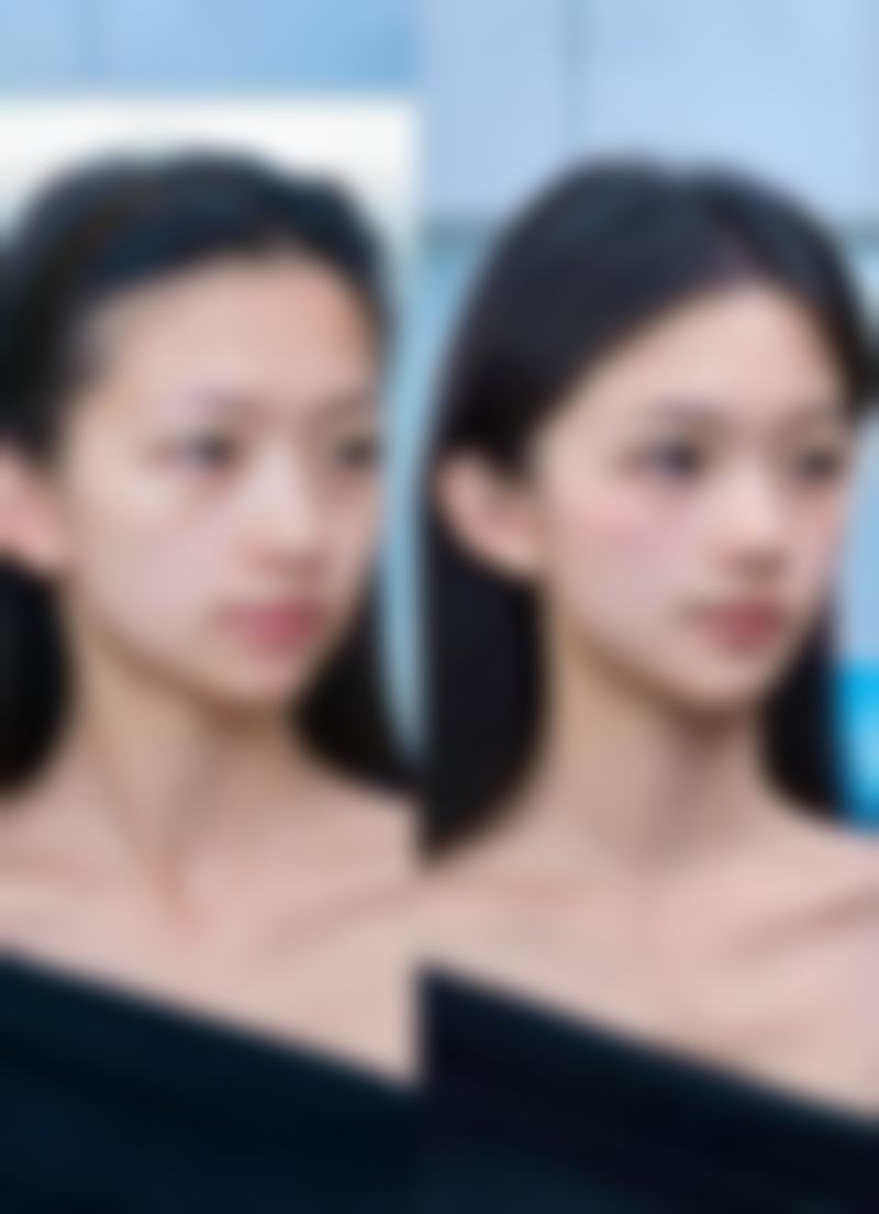 操作不当造成眼睛磨