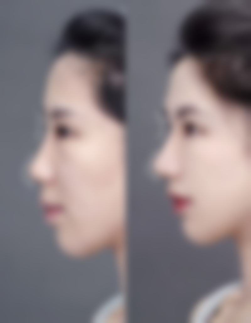 七、长沙禾丽医疗美容刘华荣医生怎么预约?