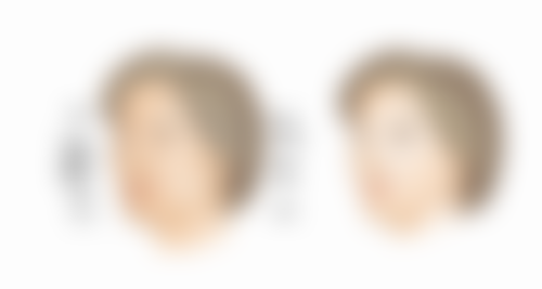 七、鞍山张玉霞星范李东山医生怎么预约?