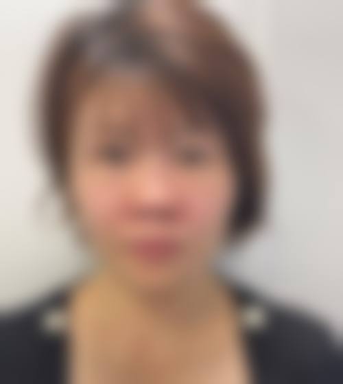 五、重庆脸璞医疗美容门诊部收费价格表