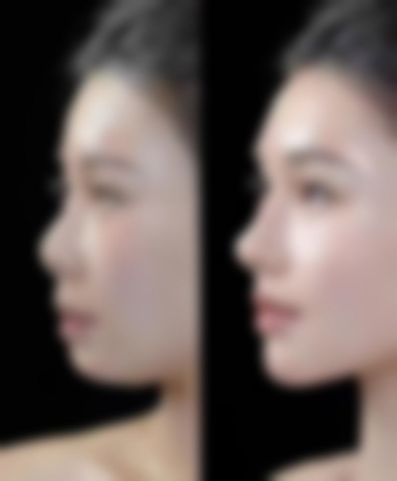 磕伤后疤痕怎么办？可根据疤痕类型针对性治疗，结合通用疗法，做好日常护理，早干预效果佳！ 