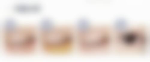 医生观点：种植头发术值得信赖