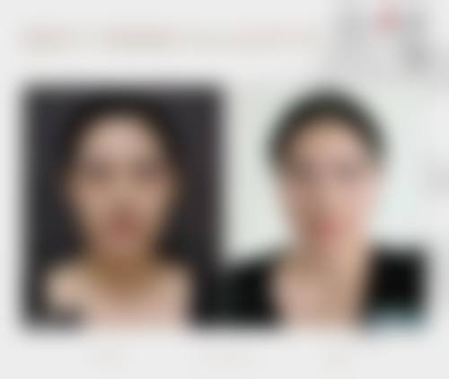 五、东莞美立方整形美容收费价格表