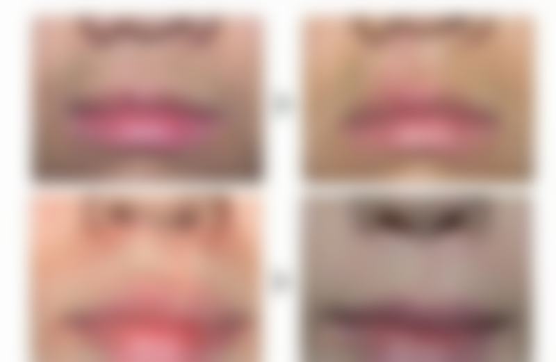 肌瘤长在子宫疤痕上怎样处理？可根据情况选药疗、手术、介入等，还需关注风险与监测！ 