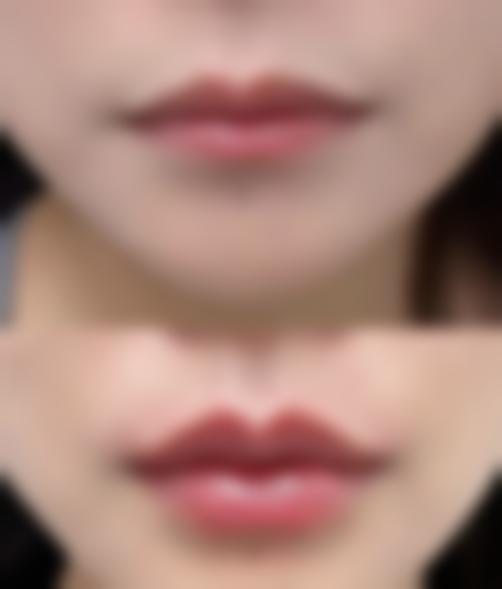 处理方法之介入