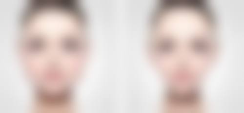 瘦脸针之后多久可以化妆？不同医生建议从24小时到10天不等，受多因素影响！ 