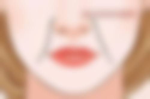 疤痕增生的形成原因及特点