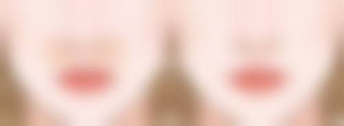 五、北京美雅枫张立彬医生技术怎么样？