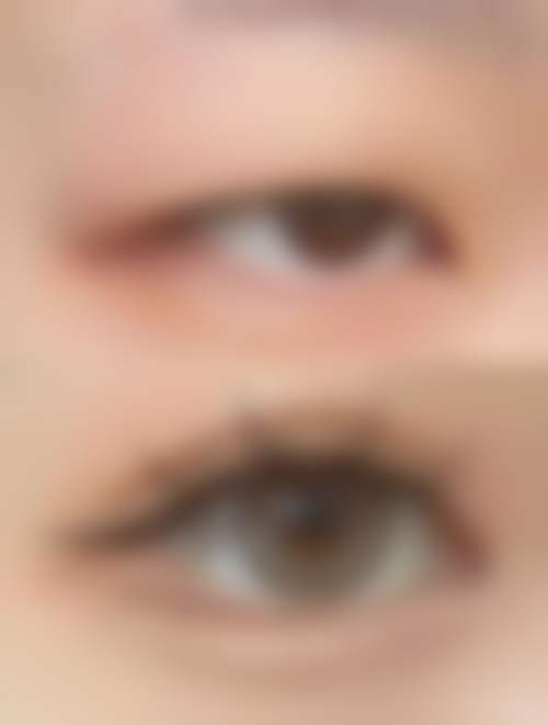 五、上海美郴医疗美容门诊部收费价格表