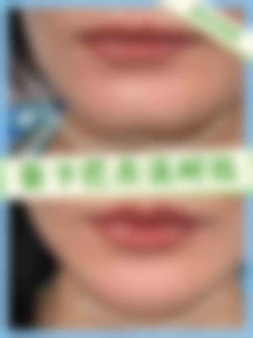 六、厦门雅偲廷华整形美容医院口碑如何？