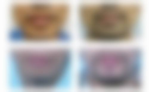 五、天津奥霏医疗美容诊所收费价格表