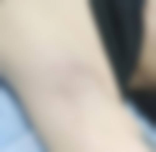 四、常州净研医疗美容门诊部特色项目