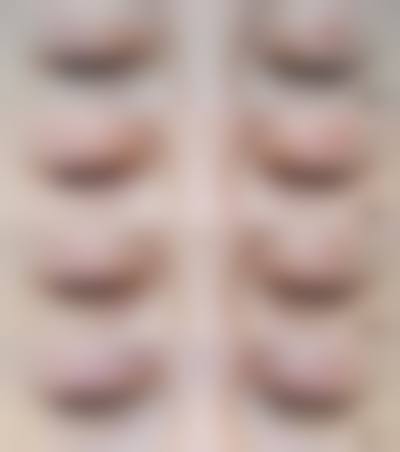 八、北京惜娜医疗美容诊所怎么预约？