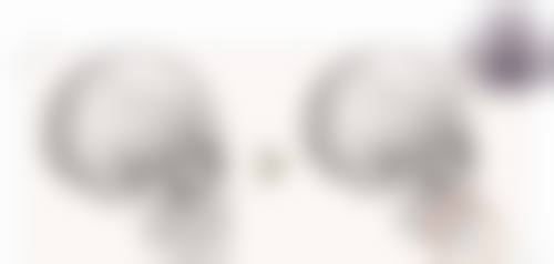 五、西安尤美医疗整形美容医院收费价格表