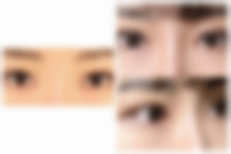 使用祛疤膏的注意事项