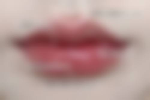 判断毛囊受损情况的方法